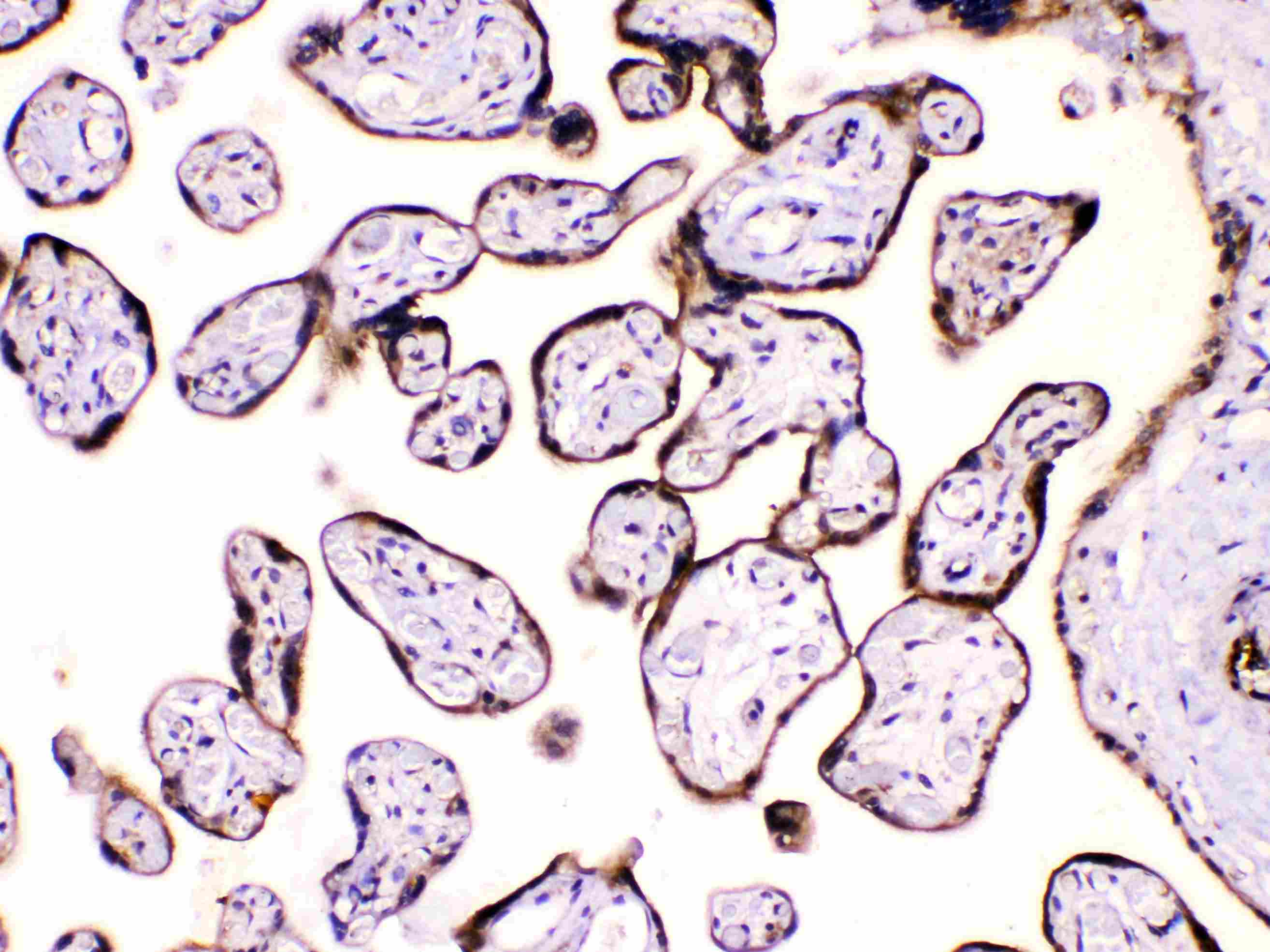 Polyclonal Rabbit anti-Human CAST / Calpastatin Antibody (IHC, WB)