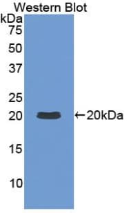 IL-1B / IL-1 Beta Antibody (aa109-251)
