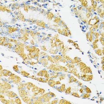 Polyclonal Rabbit anti-Human HSPA9 / Mortalin / GRP75 Antibody (IHC, IF, WB)