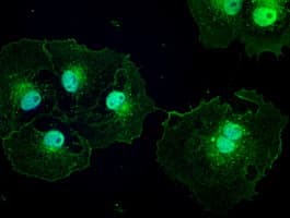 PTCH1 / Patched 1 Antibody (clone OTI5C7)