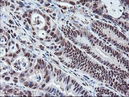 COPS5 / JAB1 Antibody (clone OTI2B12)
