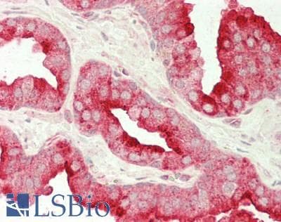 IHC-plus™ FOLH1 / PSMA Antibody (aa 48-750)