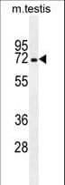 Polyclonal Rabbit anti-Human MBTD1 Antibody (aa564-592, IHC, WB)