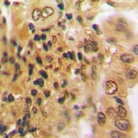 Polyclonal Rabbit anti-Human PSMD7 / MOV34 Antibody (IHC, IF, WB)