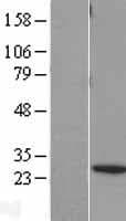 Human BNIP1 Protein (Over-Expression Lysate Myc-DDK (Flag))