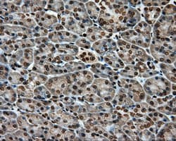APP / Beta Amyloid Precursor Antibody (clone OTI2B10)