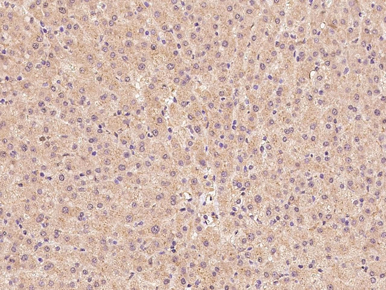 ZADH2 Antibody