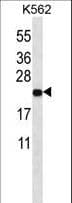 MT-ND3 Antibody (aa10-38)