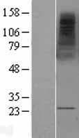 Human MS4A2 / FCERI Protein (Over-Expression Lysate Myc-DDK (Flag))