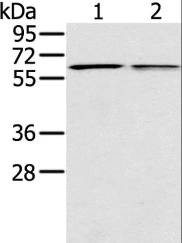 IHC-plus™ Polyclonal Rabbit anti-Human PTGER2 / EP2 Antibody (IHC, WB)