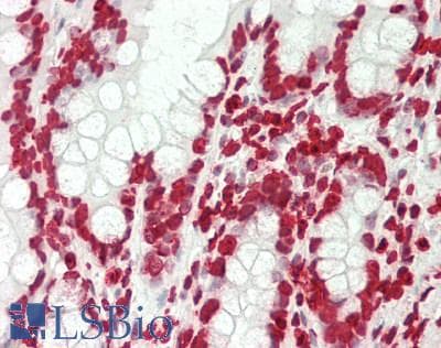 Polyclonal Rabbit anti-Human Histone H3 Antibody (aa1-136, IHC, WB)