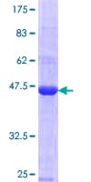 Human MAGEC1 Protein (Recombinant GST, N-terminus)