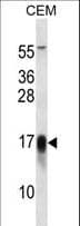 FXYD5 / Dysadherin Antibody (aa71-100)