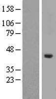 SERTAD4 Protein (Over-Expression Lysate Myc-DDK (Flag))