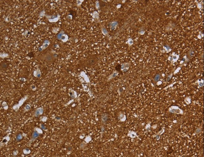 SNCG / Gamma-Synuclein Antibody