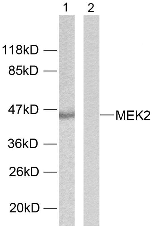 Polyclonal Rabbit anti-Human MAP2K2 / MKK2 / MEK2 Antibody (p394, IHC, WB)