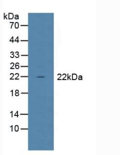 GPX1 / Glutathione Peroxidase Antibody (aa50-203, APC)