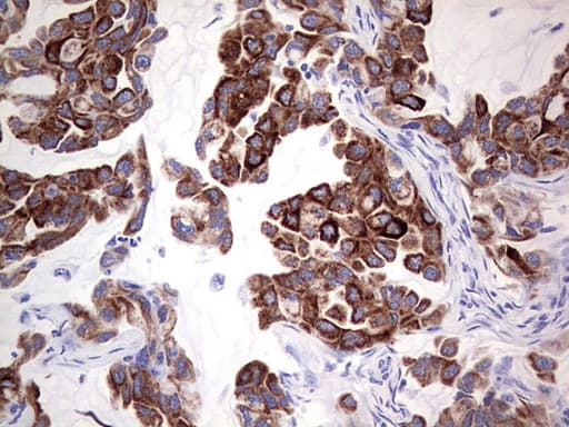 Monoclonal Mouse anti-Human KRT19 / CK19 / Cytokeratin 19 Antibody (clone OTI5F4, aa240-390, IHC, WB)