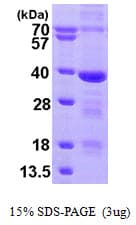 Human MED4 Protein (Recombinant His)