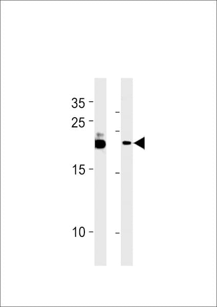 FAM216B Antibody (aa111-139)