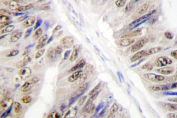 HNRNPL / hnRNP L Antibody (Gly58)
