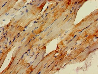 Polyclonal Rabbit anti-Human STUB1 / CHIP Antibody (IHC, IF, WB)