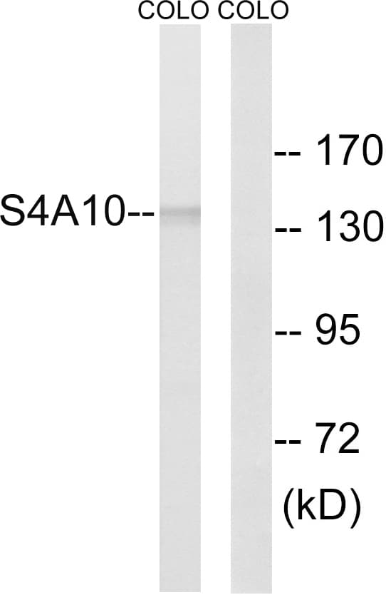Polyclonal Rabbit anti-Human SLC4A8+10 Antibody (Internal, WB)