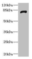 Polyclonal Rabbit anti-Human HHIP / HIP Antibody (IHC, WB)