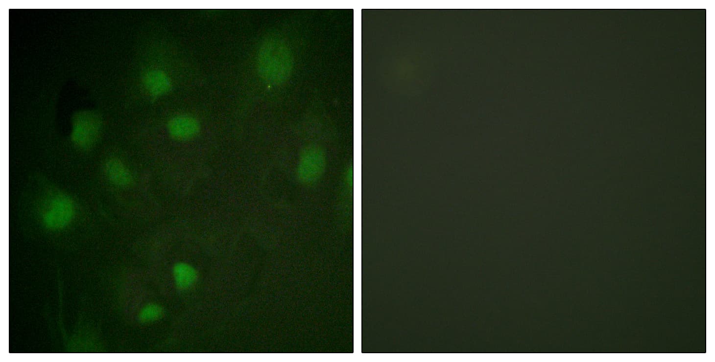 IHC-plus™ Polyclonal Rabbit anti-Human IGF2R / CD222 Antibody (aa2441-2490, IHC, IF)