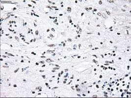 BRAF / B-Raf Antibody (clone OTI4C5)