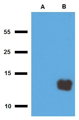 Polyclonal Rabbit anti-Mycobacterium tuberculosis Mycobacterium tuberculosis Tb10.3 Antibody (clone Polyclonal, WB)