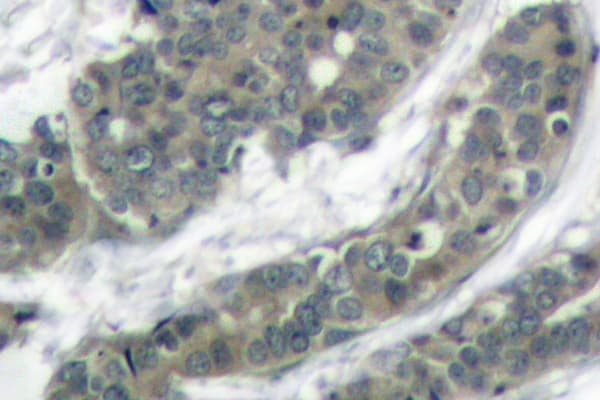 DOK1 Antibody (Arg392)