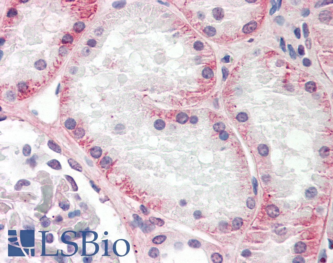 IHC-plus™ Polyclonal Rabbit anti-Human KLHL1 Antibody (aa1-30, IHC, WB)