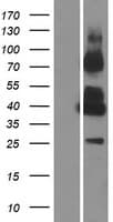 GPRC5C Protein (Over-Expression Lysate Myc-DDK (Flag))