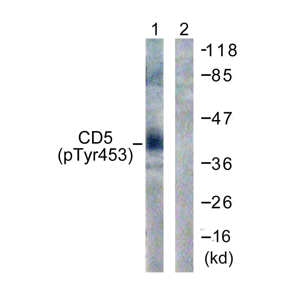 Polyclonal Rabbit anti-Human CD5 Antibody (phospho-Tyr453, IF, WB)