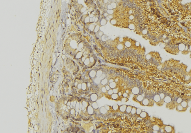 Polyclonal Rabbit anti-Human KRT20 / CK20 / Cytokeratin 20 Antibody (IHC, IF, WB)