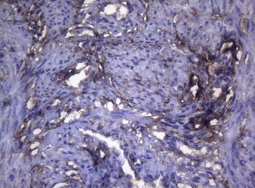LGALS3 / Galectin 3 Antibody (clone OTI8E3)