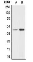 AARSD1 Antibody (Internal)
