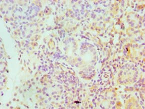 Polyclonal Rabbit anti-Human SERPINA4 / Kallistatin Antibody (aa178-427, IHC)