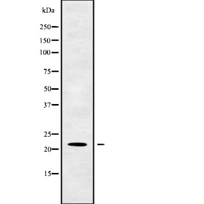 TM2D1 / BBP Antibody