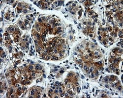 L1CAM Antibody (clone OTI3G1)