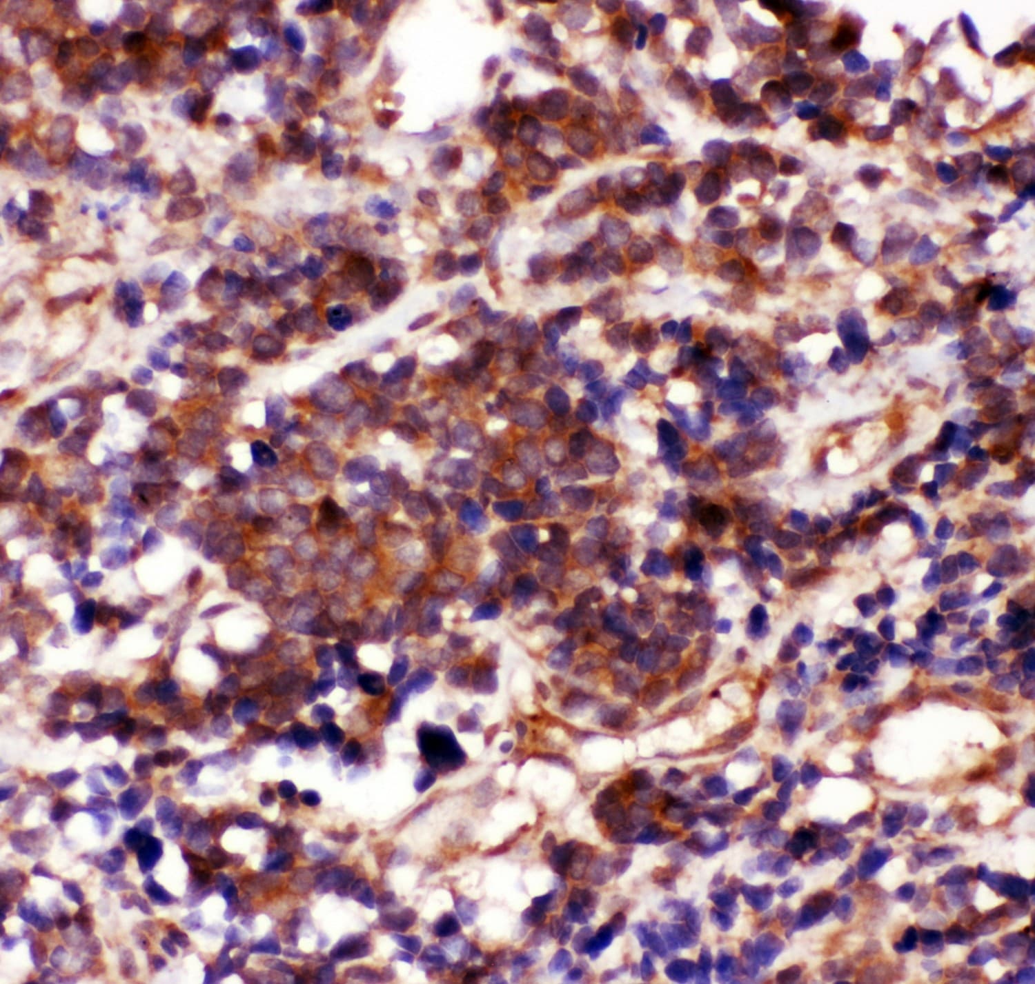 CASP3 / Caspase 3 Antibody (aa67-175)