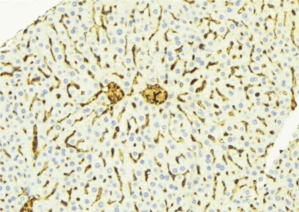 CTSD / Cathepsin D Antibody