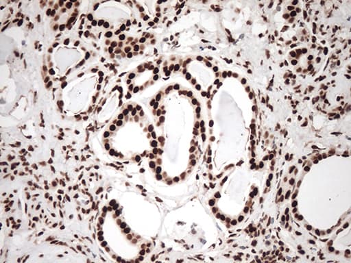 Monoclonal Mouse anti-Human TRIM28 / KAP1 Antibody (clone OTI5E10, IHC, IF, WB)