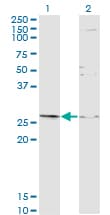 Monoclonal Mouse anti-Human TGIF2 Antibody (clone 2D4, WB)