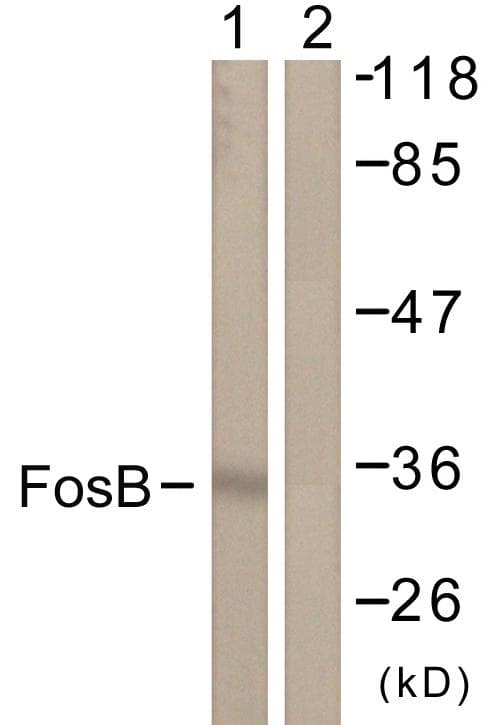 FOSB Antibody (p27)