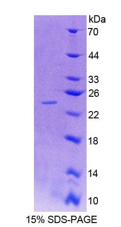 Human SDC4 / Syndecan 4 Protein (Recombinant His-T7)