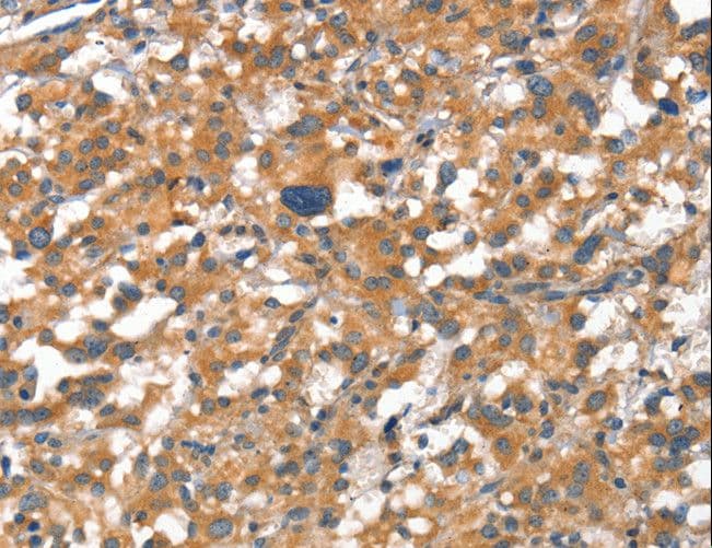 CD144 / CDH5 / VE Cadherin Antibody