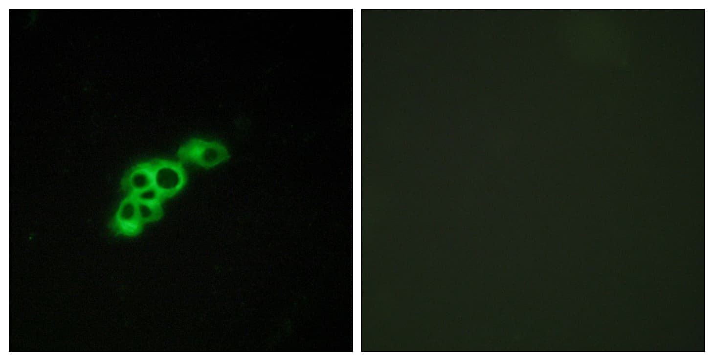 IHC-plus™ FSH Receptor / FSHR Antibody (aa278-327)