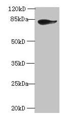 Polyclonal Rabbit anti-Human JUP/CTNNG/Junction Plakoglobin Antibody (IHC, WB)